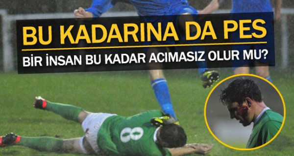 Bu kadar acmasz olunur mu?